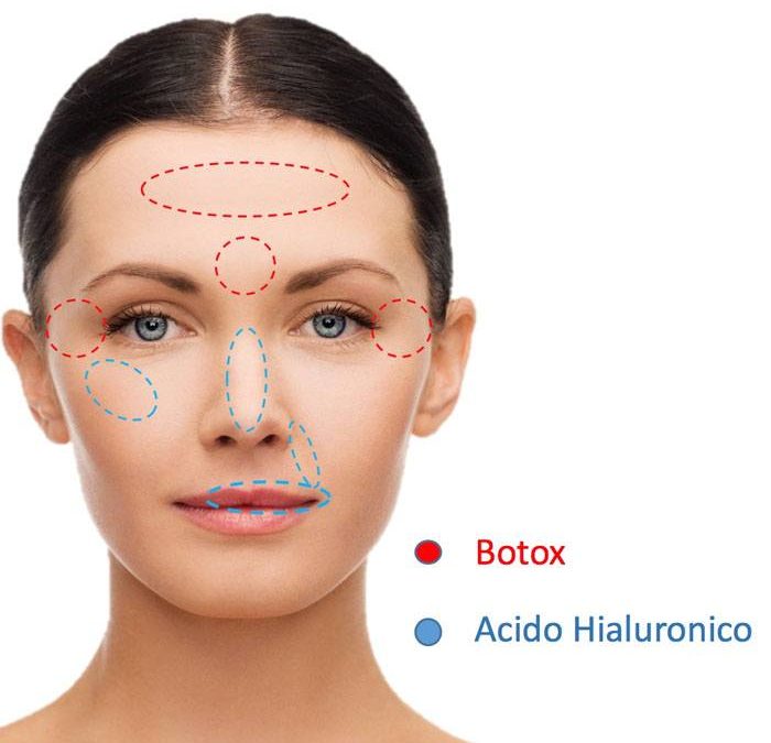 Diferencias entre el botox y el ácido hialurónico
