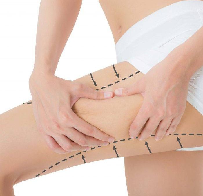 Recomendaciones a tener en cuenta en la mesoterapia