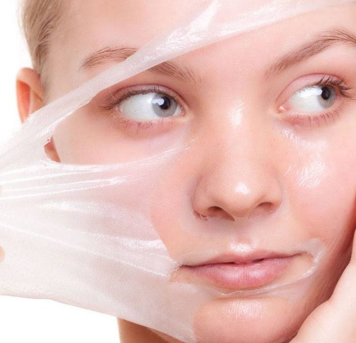 ¿Qué es un peeling facial químico?
