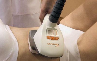Velasmooth, el mejor remedio no invasivo contra la celulitis